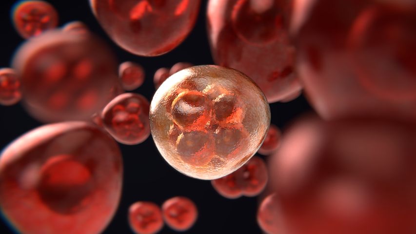 Medicina Integrativă - Abordarea Completă a Sănătății Tale Adenocarcinom