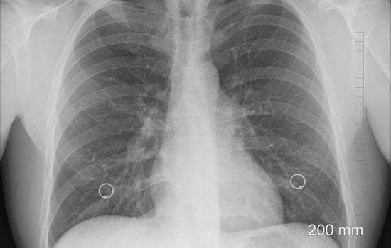 Medicina Integrativă - Abordarea Completă a Sănătății Tale