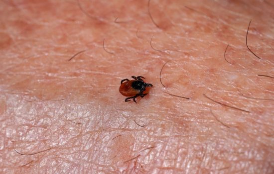 Boala Lyme este o afecțiune bacteriană, transmisă de căpușele din genul Ixodes, insectă care transmite bacteria Borrelia burgdorferi. Persoanele cu boala Lyme pot reactiona la aceasta in mod diferit, iar simptomele pot avea grade diferite de severitate