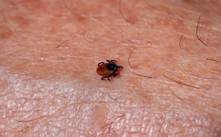 Boala Lyme este o afecțiune bacteriană, transmisă de căpușele din genul Ixodes, insectă care transmite bacteria Borrelia burgdorferi. Persoanele cu boala Lyme pot reactiona la aceasta in mod diferit, iar simptomele pot avea grade diferite de severitate