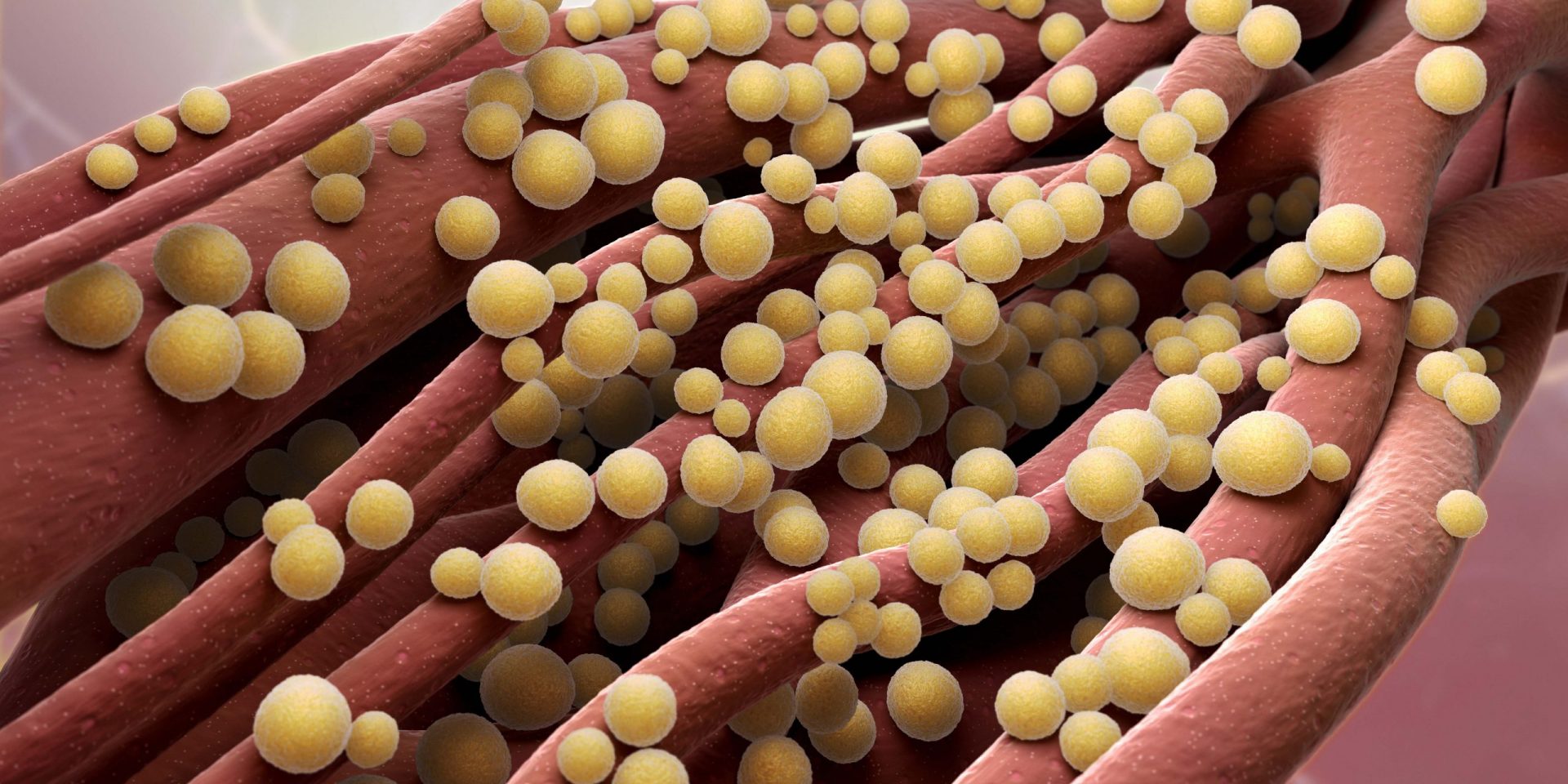 Septicemia – ce este și cum și dacă se tratează