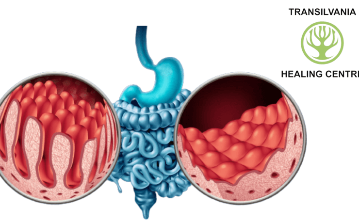gluten Descopera tot ce trebuie sa stii despre boala celiaca, inclusiv cauzele, simptomele si optiunile de tratament.