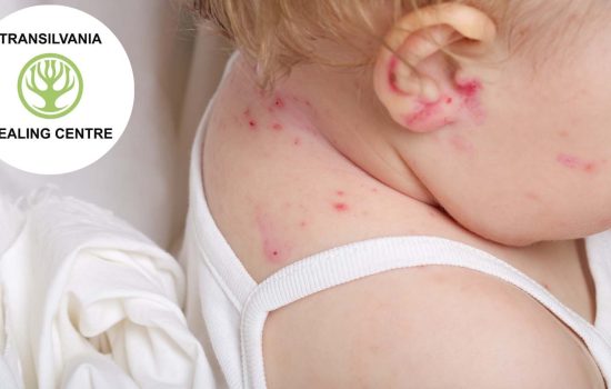 atopica Combaterea Dermatitei Atopice la Micuții Noștri - Sfaturi și Tratamente Eficiente